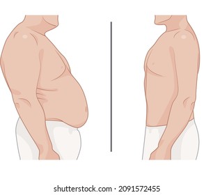 Vector image of a man without muscles and have muscles from exercise.