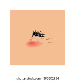 Vector Image Of A Mosquito Biting Skin