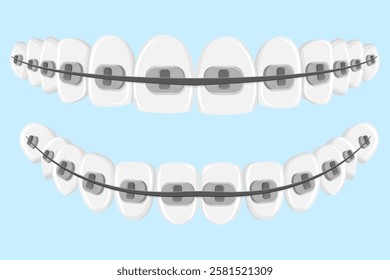 Vector image of mouth and teeth. Braces and bite correction. Dentistry and dental treatment concept. Element for your design of banners, posters, articles, etc.