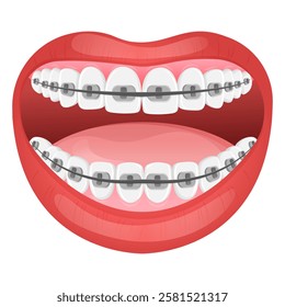 Vector image of mouth and teeth. Braces and bite correction. Dentistry and dental treatment concept. Element for your design of banners, posters, articles, etc.