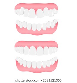 Vector image of mouth and teeth. Braces and bite correction. Dentistry and dental treatment concept. Element for your design of banners, posters, articles, etc.