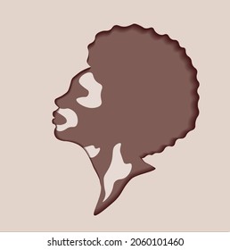 Vector image. Profile of an African American woman with vitiligo disease. Cut Out Trend illustration style. Printing of postcards, brochures, posters.