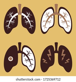 Imagen vectorial de las vías respiratorias. Iconos del órgano pulmonar que pueden ser usados como plantilla de diseño web. Virus COVID-19. Prevención del coronavirus.