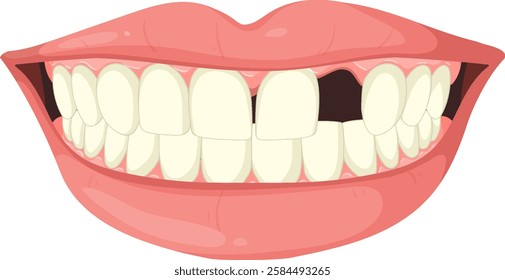 Vector image of teeth with a missing tooth