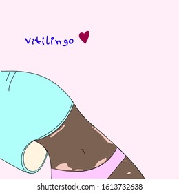 Vector image - Vitilingo skin disease on the body of a girl.  Isolated image of the silhouette of an Afro girl in lingerie and turquoise hoodie. 