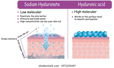 Vector Infographic Hyaluronic acid and Sodium Hyaluronate comparison scheme. Difference effect on skin low molecular penetration skin layers. Dermatology hydration explained keep moisture beauty care 