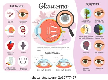 Vector infographics glaucoma. Medical poster of eye disease. Anatomy of the eyeball. Causes and symptoms of the disease.
