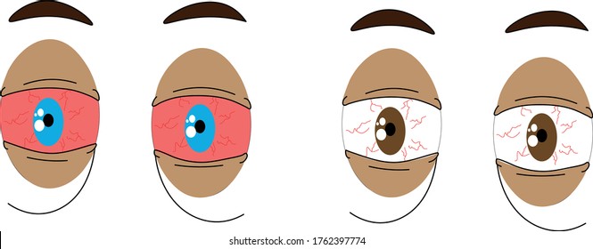 vector of irritated or tired eyes