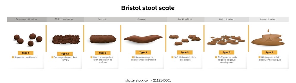 Vector isolated cartoon illustration on white of a set different types human feces, excrement in normal and diseases of diarrhea and constipation. A scale with information for correct diagnosis.