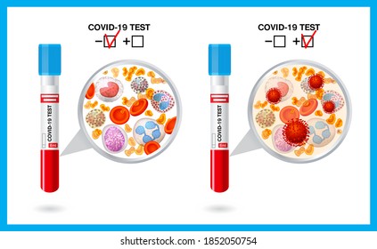 Vector isolated color illustration test tube with blood. Blood test. Test for Coronavirus Covid-19. Blood under a microscope. Positive and negative result.