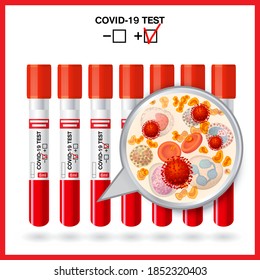Vector isolated color illustration test tube with blood. Blood test. Test for Coronavirus Covid-19. Blood under a microscope. Positive result.