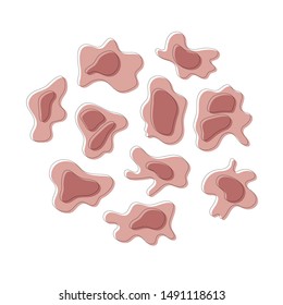 Vector isolated illustration of cancer cell structure. Medical diagram for poster, educational, science and medical use. Cancer icon or logo.