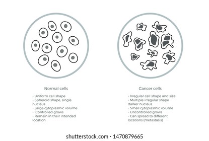 Vector isolated illustration of cell structure: normal and cancer. Medical diagram for poster, educational, science and medical use. Cancer icon or logo.