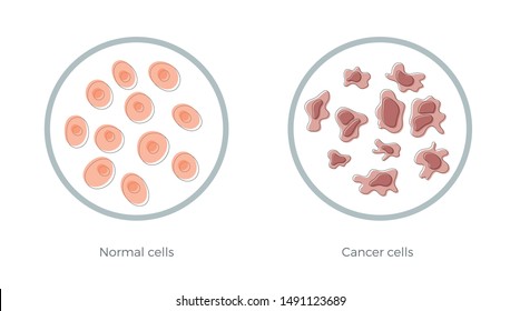 Vector isolated illustration of cell structure: normal and cancer. Medical diagram for poster, educational, science and medical use. Cancer icon or logo.