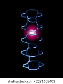 Vector isolated illustration of cervical vertebrae. Neon contour drawing of the cervical spine. Neck pain. Displacement of the vertebrae.