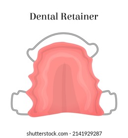 Vector isolated illustration with dental retainer. The concept of dentistry, dental care, correction of bite, uneven teeth. You can use the element in posters, banners, web design, etc.