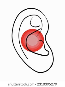 Vector isolated illustration of ear diseases. Pain in the ear. Cerumen. Otitis. Otolaryngologist.
