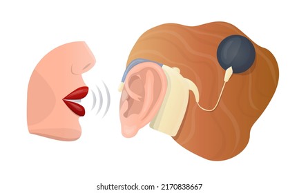 Vector isolated illustration with an ear and a hearing aid, where the sound processor is attached with a pin to the temporal bone and mouth that whispering. Concept treatment of hearing loss, otology.