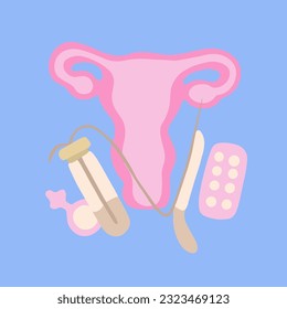 Vektorgrafik der Eizellenspende. In-vitro-Fertilisation. Künstliche Befruchtung. Transvaginale Eizellenentnahme.