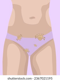 Vector ilustrado de piojos púbicos hembra. Contacto con una persona con piojos públicos.