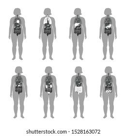Vector isolated illustration of human internal organs in obese female body. Stomach, liver, intestine, bladder, lung, uterus, spine, pancreas, kidney, heart, bladder icon. Medical poster 
