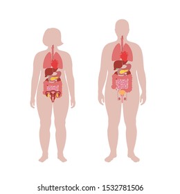 Vector isolated illustration of human internal organs in obese male and woman body. Stomach, liver, intestine, bladder, lung, uterus, spine, pancreas, kidney, heart, bladder icon. Medical poster 