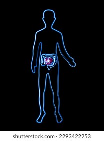 Ilustración aislada de un ser humano con marcado intestinal. Enfermedades intestinales. Sistema digestivo humano. Diarrea.