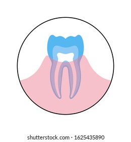 Vector isolated illustration of human tooth in gum anatomy infographics. Medical banner or poster illustration.