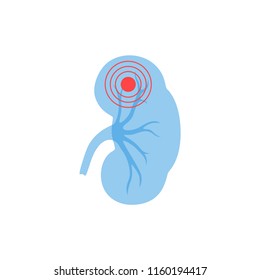 Vector isolated illustration of kidney anatomy. Human excretory system icon. Healthcare medical center, surgery, hospital, clinic, diagnostic logo. Internal donor organ symbol poster design. Donation