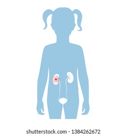 Vector isolated illustration of kidney anatomy in girl body. Human excretory system icon. Healthcare medical center, surgery, hospital, clinic logo. Internal donor organ symbol poster design. Donation