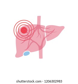 Vector isolated illustration of liver anatomy. Human digestive system icon. Healthcare medical center, surgery, hospital, clinic, diagnostic logo. Internal donor organ symbol poster design. Donation 