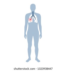 Vector isolated illustration of lung anatomy. Human respiratory system icon. Healthcare medical center, surgery, hospital, clinic, diagnostic logo. Internal donor organ symbol poster design. donation
