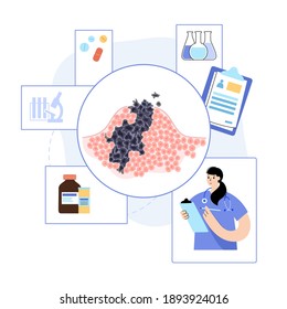 Vector isolated illustration of malignant tumor in healthy tissue. Doctor in laboratory. Spreading of cancer cells, tumor development concept. Medical infographic for poster, science and medical use.