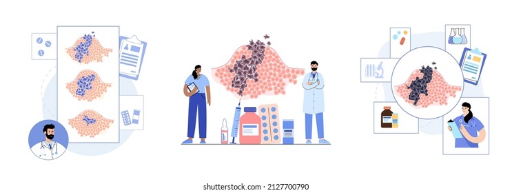 Vector isolated illustration of malignant tumor in healthy tissue. Doctor in laboratory. Spreading of cancer cells, tumor development concept. Medical infographic for poster, science and medical use.