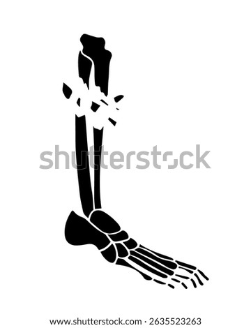 Vector isolated illustration of an open fracture of the tibia. X-ray of the leg.	