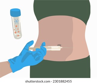 Vector isolated illustration of ovulation stimulation process. Egg donation. Ovary stimulation. Egg freezing. Artificial insemination.