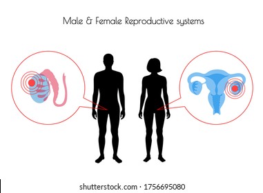 Vector aislado ilustra el dolor y la inflamación en el sistema reproductivo en la silueta de mujeres y hombres. Utero negro aislado, cervix, ovario y otros órganos icono en el cuerpo.