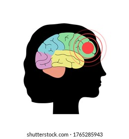 Vector Isolated Illustration Of Pain, Inflammation Or Tumor In Human Adult Female Brain Anatomy. Occipital, Frontal, Parietal And Temporal Lobe. Medical Infographics For Poster.