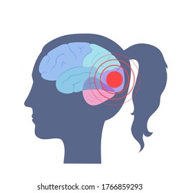 Vector Isolated Illustration Of Pain, Inflammation Or Tumor In Human Adult Female Brain Anatomy. Occipital, Frontal, Parietal And Temporal Lobe. Medical Infographics For Poster.