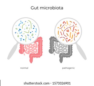 Vector isolated illustration of pathogenic and normal human microbiota, bad and good bacteria. Medical infographics for poster, educational, science 