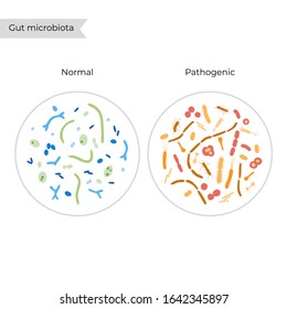 Vector isolated illustration of pathogenic and normal human microbiota, bad and good bacteria. Medical infographics for poster, educational, science 