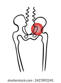 Vektorisolierte Illustration einer Beckenknochenverletzung. Beckenfraktur. Schmerzen im Beckenknochen.	