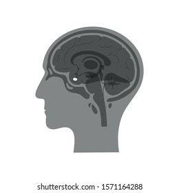 Vector isolated illustration of Pituitary gland in man head. Human brain components detailed anatomy. Medical infographics for poster, educational, science and medical use. Sagittal view of brain