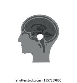 Vector isolated illustration of Pons hindbrain, part of brain stem in man head. Human brain anatomy. Medical infographics for poster, educational, science and medical use. Sagittal view of brain