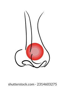 Ilustración aislada del vector de sinusitis. Congestión nasal. Frío. Síntomas fríos.