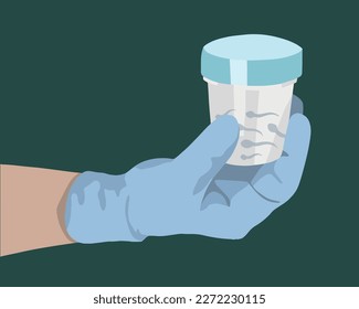 Vector isolated illustration of sperm donation. Sperm in a container. Spermogram analysis.