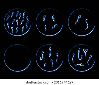 Vektorgrafik, einzelne Illustration von Spermienpathologien. Spermogramm. Spermienfehler. Defekte des Spermienkopfes.  Spermienmotilität.