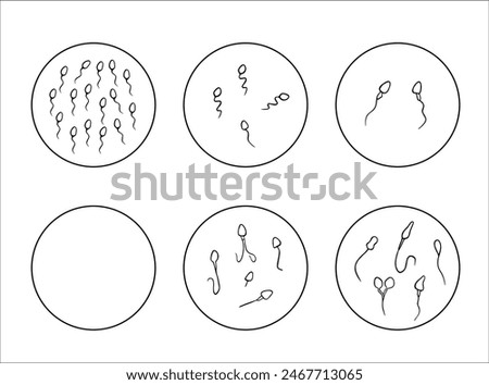 Vector isolated illustration of sperm pathologies. Spermogram. Sperm defects. Defects of the sperm head. Sperm motility.	