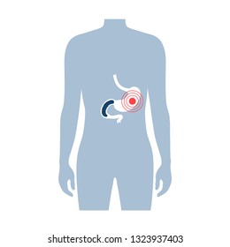 Vector isolated illustration of stomach anatomy. Human digestive system icon. Healthcare medical center, surgery, hospital, clinic, diagnostic logo. Internal organ symbol poster design. Donation 