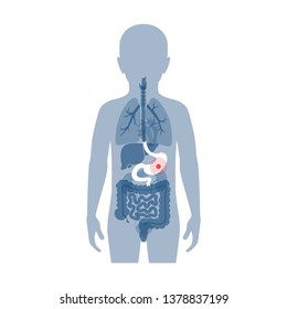 Vector isolated illustration of stomach anatomy in boy body. Human digestive system icon. Healthcare medical center, surgery, hospital, clinic, diagnostic logo. Internal child organ design. Donation 